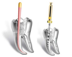 Endodontie